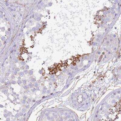 Immunohistochemistry: NBPF3 Antibody [NBP2-46699]