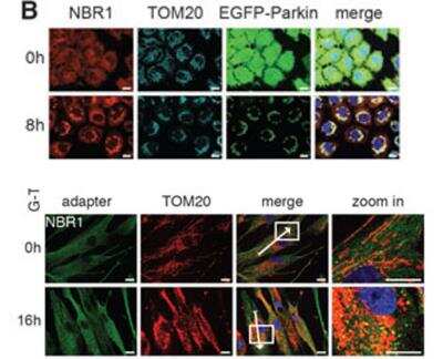 Immunocytochemistry/ Immunofluorescence: NBR1 Antibody (6B11) [H00004077-M01]