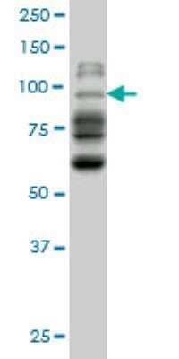 Western Blot: NBR1 Antibody (6B11) [H00004077-M01]