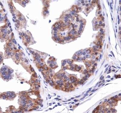 Immunohistochemistry: NBR1 Antibody - BSA Free [NBP1-71703]