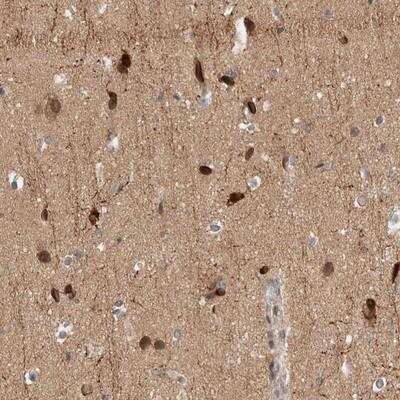 Immunohistochemistry: NBR1 Antibody [NBP1-89400]