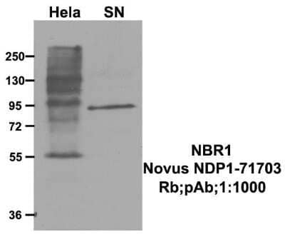 Western Blot: NBR1 AntibodyBSA Free [NBP1-71703]