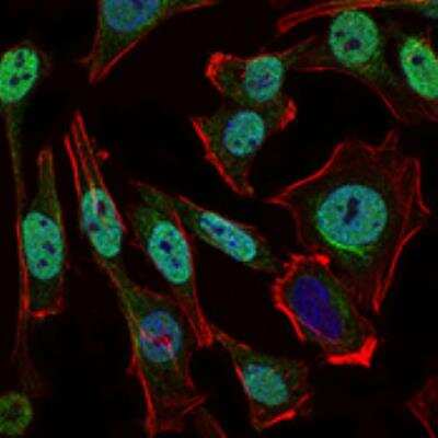 Immunocytochemistry/ Immunofluorescence: Nbs1 Antibody (7E4A2) [NBP2-26297]