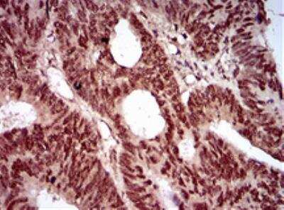 Immunohistochemistry: Nbs1 Antibody (7E4A2) [NBP2-26297]