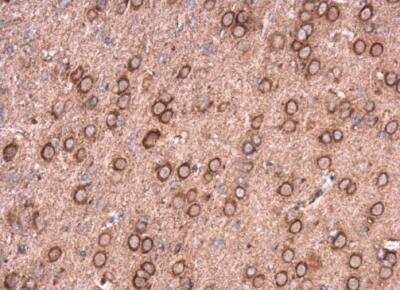 Immunohistochemistry-Paraffin: NCALD Antibody [NBP2-15037]