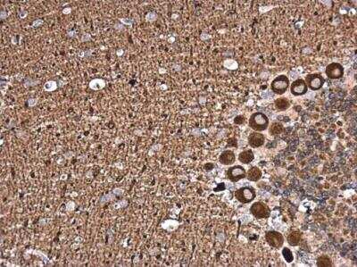 Immunohistochemistry-Paraffin: NCALD Antibody [NBP2-15037]