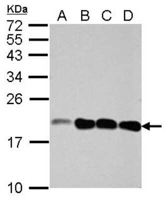 Western Blot: NCALD Antibody [NBP2-15037]