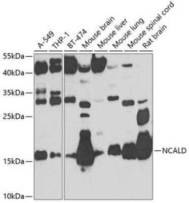 Western Blot: NCALD AntibodyBSA Free [NBP2-93693]