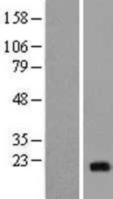 Western Blot: NCALD Overexpression Lysate [NBL1-13500]