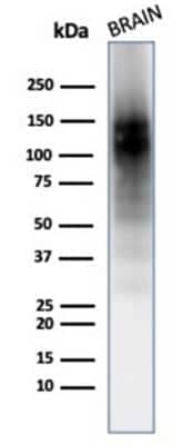 Western Blot: NCAM-1/CD56 Antibody (123A8 (same as 56C04))Azide and BSA Free [NBP2-34518]