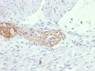 Immunohistochemistry-Paraffin: NCAM-1/CD56 Antibody (123A8 (same as 56C04)) - IHC-Prediluted [NBP2-44713]