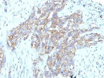 Immunohistochemistry-Paraffin: NCAM-1/CD56 Antibody (123C3.D5 + 123A8) - Azide and BSA Free [NBP2-34519]