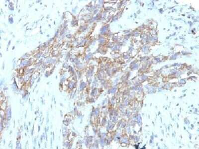 Immunohistochemistry-Paraffin: NCAM-1/CD56 Antibody (123C3.D5 + 123A8) - IHC-Prediluted [NBP2-44715]