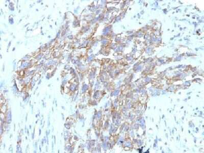 Immunohistochemistry-Paraffin: NCAM-1/CD56 Antibody (123C3.D5 + 123A8) [NBP2-34280]