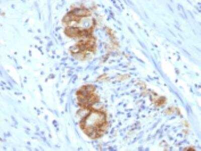 Immunohistochemistry-Paraffin: NCAM-1/CD56 Antibody (123C3.D5) - IHC-Prediluted [NBP2-44711]