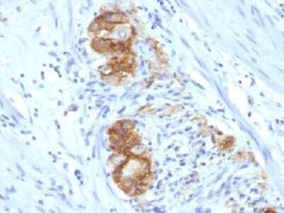 Immunohistochemistry-Paraffin: NCAM-1/CD56 Antibody (123C3.D5) [NBP2-15184]
