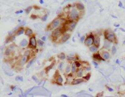 Immunohistochemistry-Paraffin: NCAM-1/CD56 Antibody (123C3.D5) [NBP2-15184]