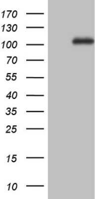 Western Blot: NCAM-1/CD56 Antibody (OTI1B9) [NBP2-46107]