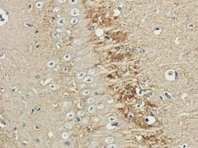 Immunohistochemistry: NCAM-1/CD56 Antibody (735) - Chimeric - Azide and BSA Free [NBP2-52669]