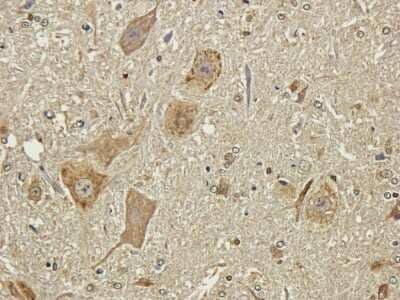 Immunohistochemistry: NCAM-1/CD56 Antibody (735) - Chimeric - Azide and BSA Free [NBP2-52669]