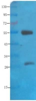 Western Blot: NCAM-1/CD56 Antibody (735)ChimericAzide and BSA Free [NBP2-52669]