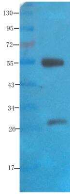 Western Blot: NCAM-1/CD56 Antibody (735)Azide and BSA Free [NBP2-52710]