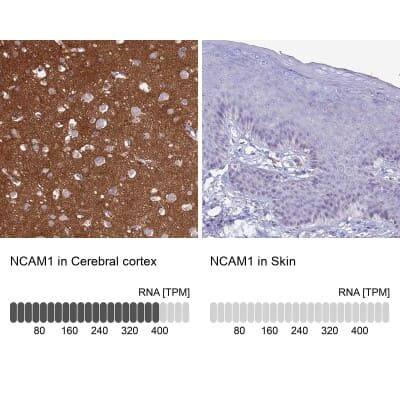 Immunohistochemistry-Paraffin: NCAM-1/CD56 Antibody [NBP2-38452]