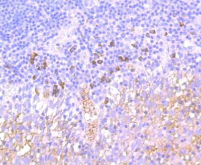Immunohistochemistry-Paraffin: NCAM-1/CD56 Antibody (JF1021) [NBP2-66968]