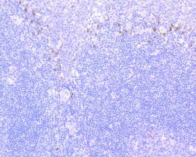 Immunohistochemistry-Paraffin: NCAM-1/CD56 Antibody (JF1021) [NBP2-66968]