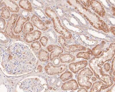 Immunohistochemistry-Paraffin: NCAM-1/CD56 Antibody (JF1021) [NBP2-66968]