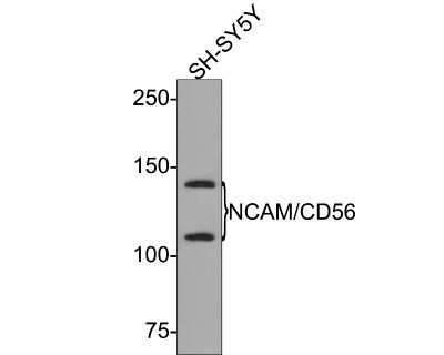 Western Blot: NCAM-1/CD56 Antibody (JF1021) [NBP2-66968]