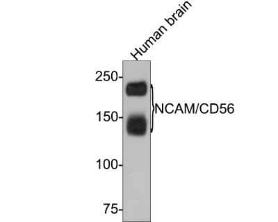 Western Blot: NCAM-1/CD56 Antibody (JF1021) [NBP2-66968]