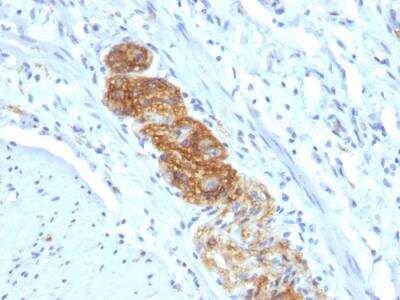 Immunohistochemistry-Paraffin: NCAM-1/CD56 Antibody (NCAM1/784) - IHC-Prediluted [NBP2-48192]