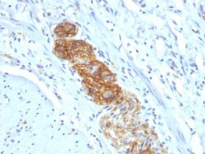 Immunohistochemistry-Paraffin: NCAM-1/CD56 Antibody (NCAM1/784) [NBP2-44716]