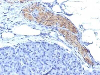 Immunohistochemistry-Paraffin: NCAM-1/CD56 Antibody (NCAM1/795) - Azide and BSA Free [NBP2-47826]