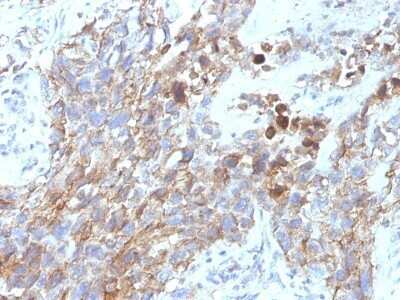 Immunohistochemistry-Paraffin: NCAM-1/CD56 Antibody (NCAM1/795) - Azide and BSA Free [NBP2-47826]