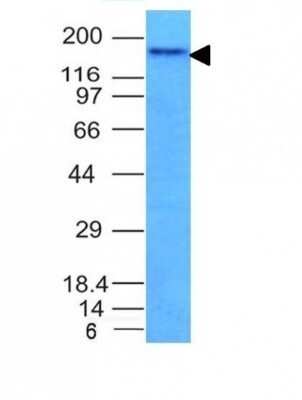 Western Blot: NCAM-1/CD56 Antibody (NCAM1/795)Azide and BSA Free [NBP2-47826]