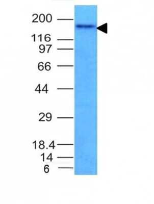 Western Blot: NCAM-1/CD56 Antibody (NCAM1/795) [NBP2-44717]