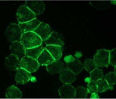 Immunohistochemistry: NCAM-1/CD56 Antibody (RNL-1) - BSA Free [NBP1-97717]