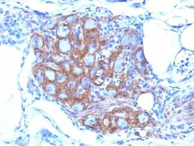 Immunohistochemistry-Paraffin: NCAM-1/CD56 Antibody (SPM128) - Azide and BSA Free [NBP2-34397]