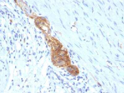 Immunohistochemistry-Paraffin: NCAM-1/CD56 Antibody (SPM489) - Azide and BSA Free [NBP2-34412]