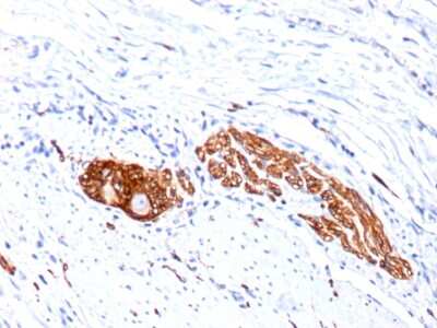 Immunohistochemistry-Paraffin: NCAM-1/CD56 Antibody (SPM489) [NBP2-34364]