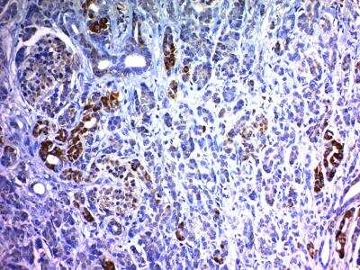 Immunohistochemistry-Paraffin: NCAM-1/CD56 Antibody (SPM489) [NBP2-34364]