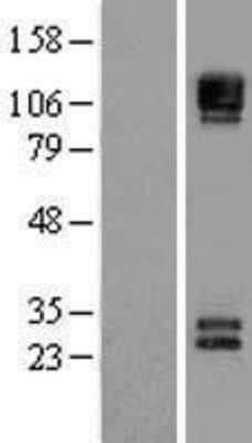 Western Blot: NCAM-1/CD56 Overexpression Lysate [NBL1-13501]