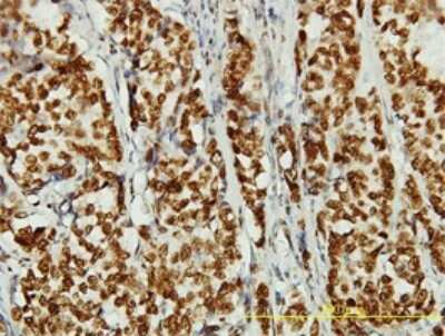 Immunohistochemistry-Paraffin: NCAPD3 Antibody (1D5) [H00023310-M01]