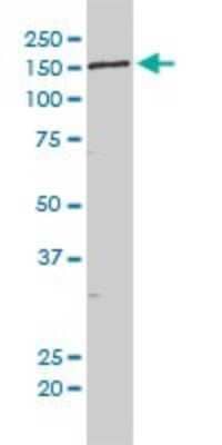 Western Blot: NCAPD3 Antibody (1D5) [H00023310-M01]