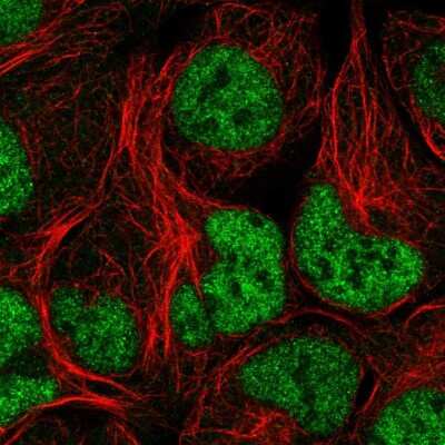 Immunocytochemistry/ Immunofluorescence: NCAPD3 Antibody [NBP2-55493]