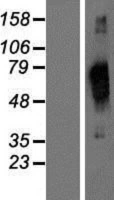 Western Blot: NCAPD3 Overexpression Lysate [NBP2-07194]