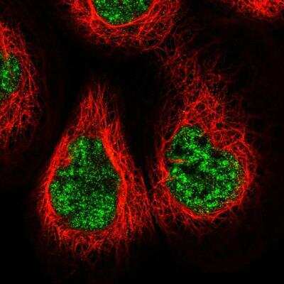 Immunocytochemistry/ Immunofluorescence: NCAPG2 Antibody [NBP1-86633]