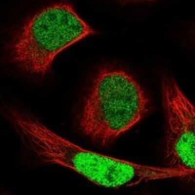 Immunocytochemistry/ Immunofluorescence: NCAPG2 Antibody [NBP3-17400]